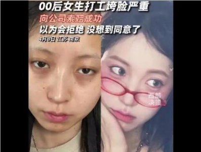 ​南京00后女生打工垮脸，公司赔了万元“颜值折损费”，还放了3天美容假