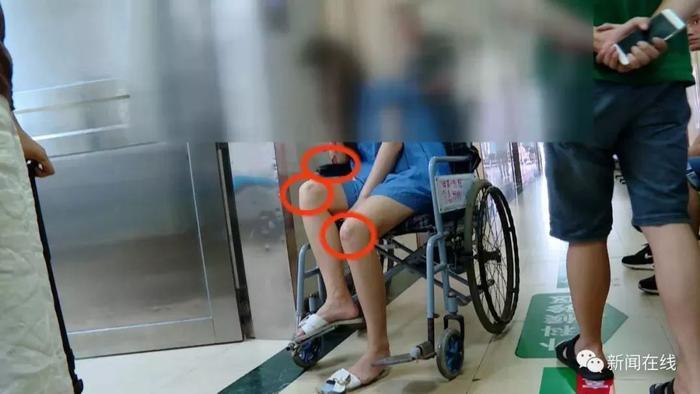 “被人带到酒店房间…”南宁失踪美女现身,身体多处明显淤青