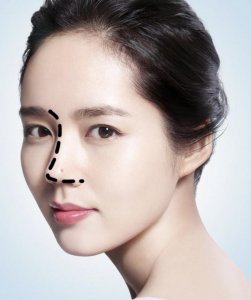 ​江苏苏王-韩佳人的鼻子到底美在哪里呢？
