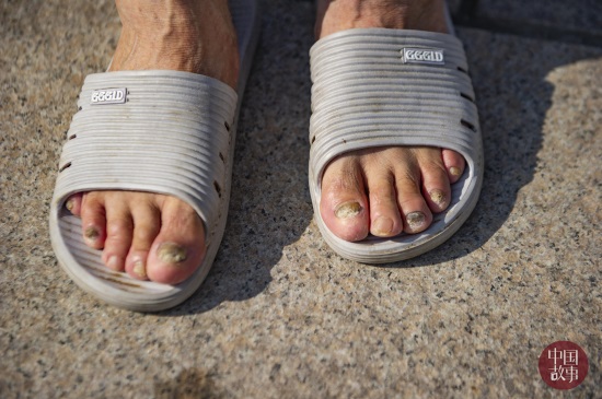 梦想的力量!山东淄博75岁大爷学跳芭蕾 脚趾甲都被磨变色