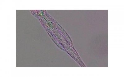 ​屡次相亲失败，自信心被打击到怎么办？