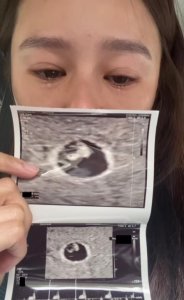 ​黄翠如宣布怀孕晒超声照泪流满面，自曝曾流产！多张孕妇照曝光