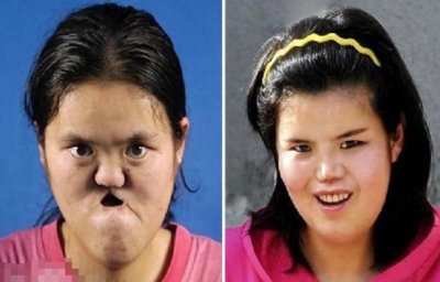 ​“坑脸弃婴”王娜：世界首例，整容成少女，和自己哥哥喜结连理