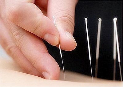 ​为什么一些祖传中医快绝迹了?