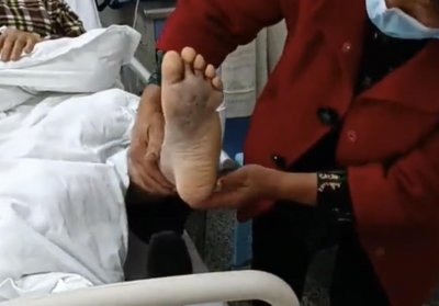 ​被窝惊现“烂草蛇”！四川70岁老人被咬伤！这是什么蛇？有多毒？