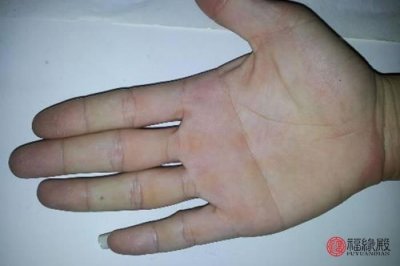 ​断掌纹的男人，双手断掌纹的男人命运怎么样