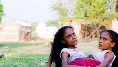 ​印度连体姐妹共用下半身，嫁同一丈夫，丈夫：我平等地爱着她们俩