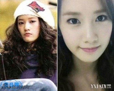 ​允儿整容前，林允儿割双眼皮(林允儿整过容吗)