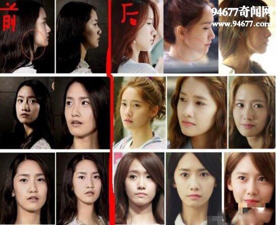 允儿整容前，林允儿割双眼皮(林允儿整过容吗)