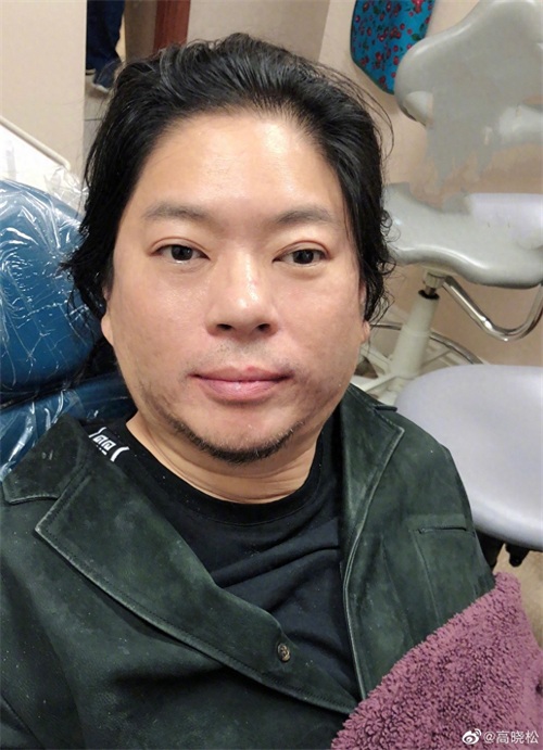 笑到想炸！高晓松的神级自拍合集