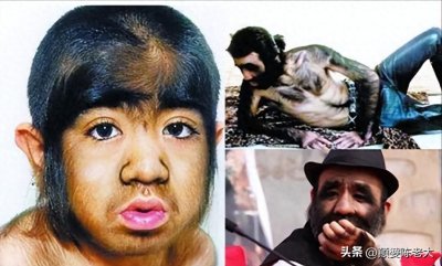​当年轰动一时的“毛孩”：42岁娶90后娇妻，生下一子未遗传长毛
