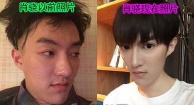 ​肖骁整容前后照片对比 肖骁大王关系是朋友还是恋人？