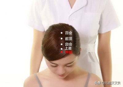 ​艾灸神庭穴：治疗失眠、癫狂、眩晕、中风